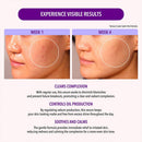 Oil Control Serum (1 unit)